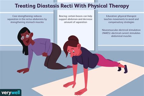 Treating Diastasis Recti With Physical Therapy