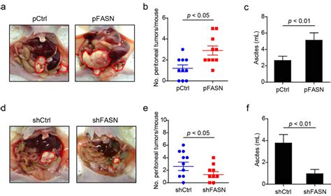 Ijms Free Full Text Up Regulated Fasn Expression Promotes