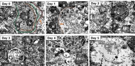 Typical Tem Images Of L Vannamei Hepatopancreas Tissue During Cold