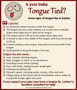 Tongue Tie and Breastfeeding - Love and Breast Milk