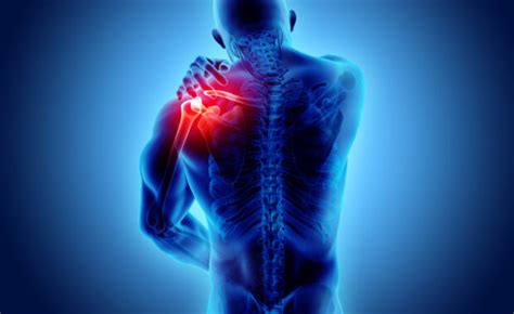 causes of shoulder pain Archives - Southern Pain and Neurological