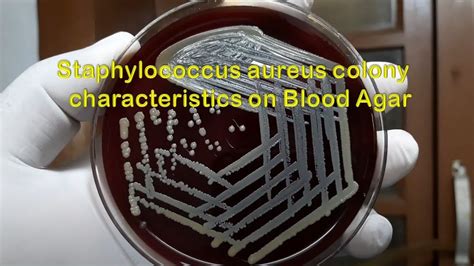 Staphylococcus Aureus Colony Characteristics On Blood Agar Youtube