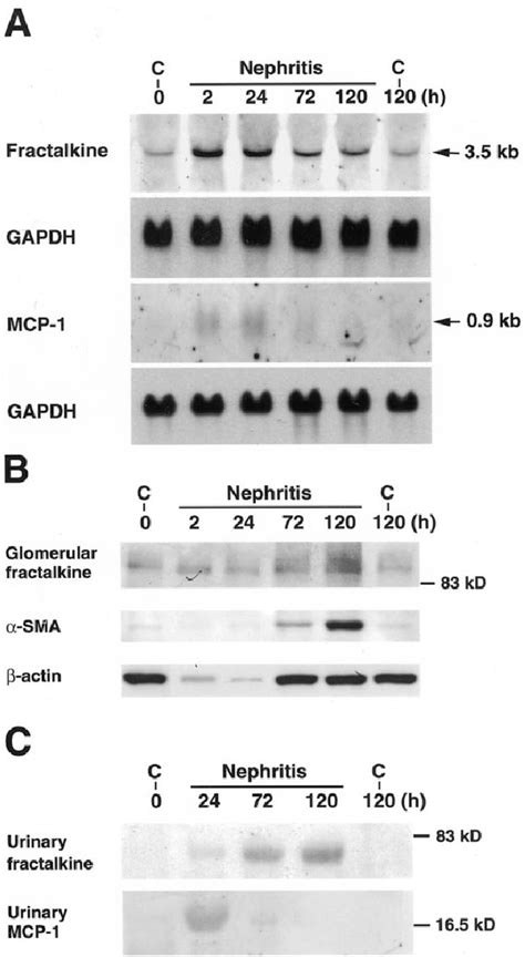 Figure 1 From Expression Of Cx3cl1fractalkine By Mesangial Cells In