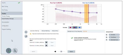 Notch Therapy For Tinnitus Offered In Signia Primax Hearing Aids