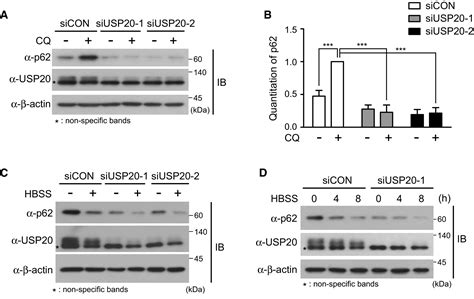 The Deubiquitinating Enzyme Usp Stabilizes Ulk And Promotes