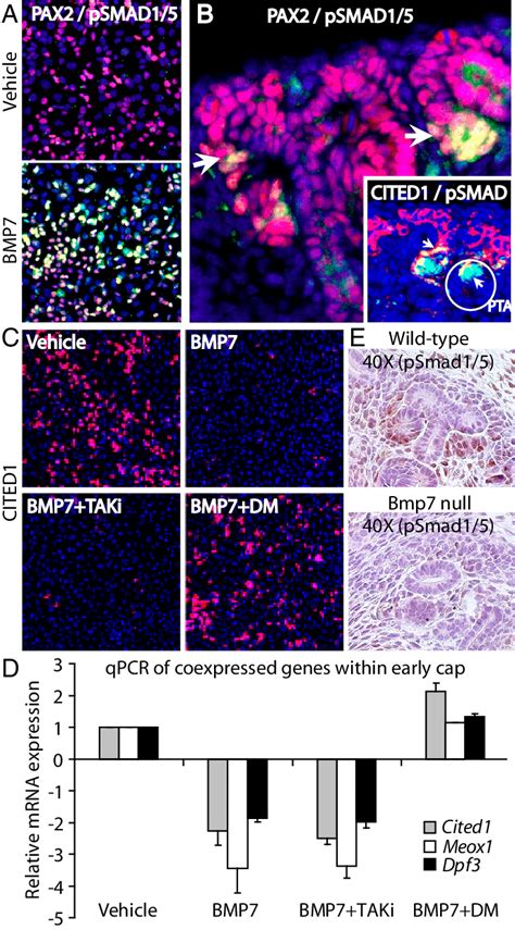 Bmp Promotes Smad Mediated Signaling In Nephron Progenitors A Bmp