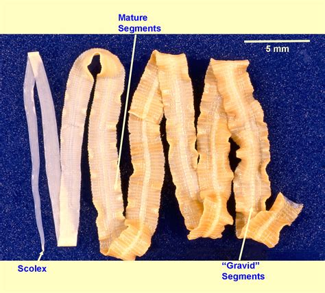 Diphyllobothrium Latum