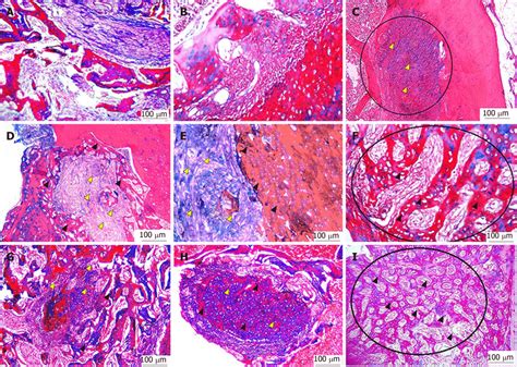 Masson S Trichrome Staining A C Decalcified M Thick Sections