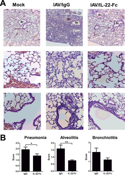 Histological Analysis Of Lung Sections From Iav Infected At Days