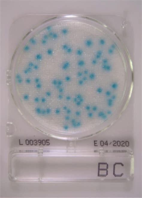 Compact Dry BC Test Af Bacillus Cereus Food Diagnostics