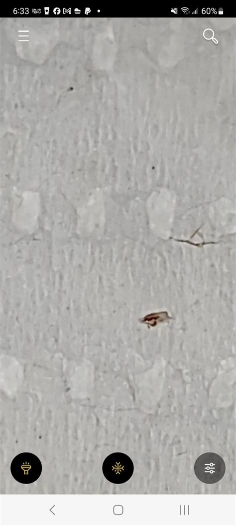 Is this a baby lice?!? These are zoomed in : r/Lice