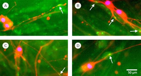 Stemdiff Motor Neuron Maturation Kit Stemcell Technologies