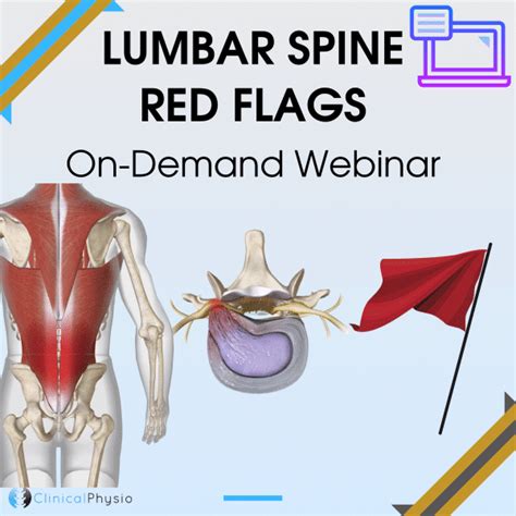 Lumbar Spine Red Flags On-Demand Webinar | Clinical Physio