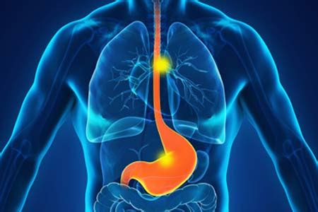 Esophageal Cancer Treatment in India - Causes, Hospitals