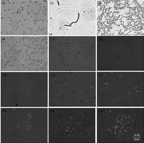 Fluorescence Micrographs Of The Bacterial Culture Samples Of Different