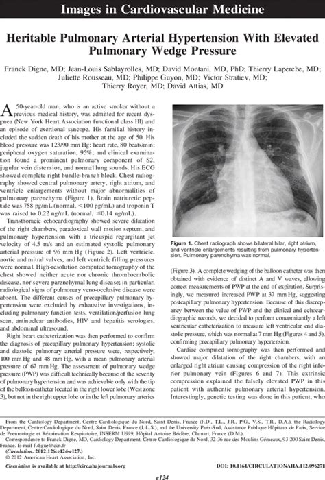 Heritable Pulmonary Arterial Hypertension With Elevated Pulmonary Wedge Pressure Circulation