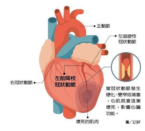 什麼是冠狀動脈？為什麼會阻塞？冠狀動脈相關疾病有哪些？｜心臟血管｜醫療｜元氣網