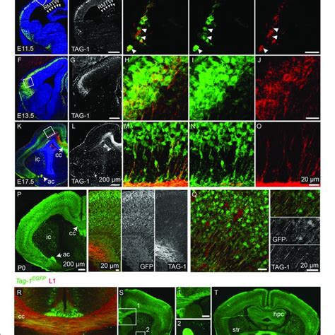 Macroscopic Cortical Defects In Postnatal Emx1 Cre Tag 1 Dta Mice