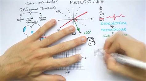 raíz Enajenar sacudir calculo eje cardiaco electrocardiograma fecha