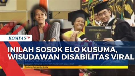 Sosok Elo Kusuma Wisudawan Disabilitas Unbraw Salam Dosen Pakai Kaki