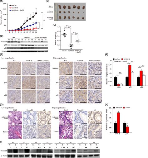 Neurogenic Differentiation Factor Neurod Silencing Suppresses