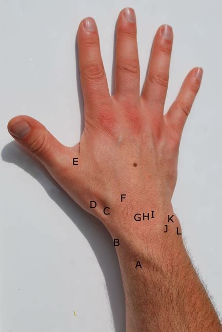 Diagnose Yourself Oxford Orthopaedics