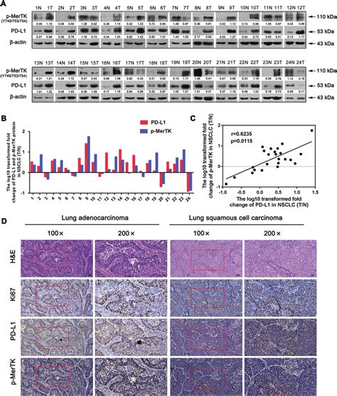 Pd L1 Is Positively Correlated With P Mertk Protein Levels In Human