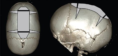 Surgical Neurology International