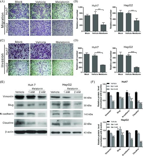 Melatonin Suppressed Hcc Cell Migration And Invasion By Inhibiting Emt