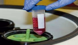 Pesticide Residue Analysis, Pesticide Residue Testing | Gujarat Laboratory