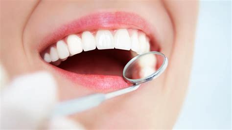 Treating Cavities With Tooth Colored Dental Fillings Tooth Colored