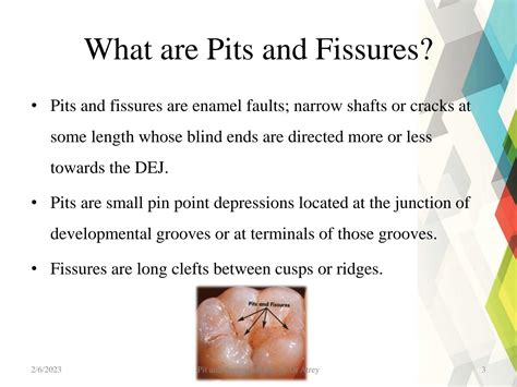 SOLUTION Pit And Fissure Sealants Ppt Studypool