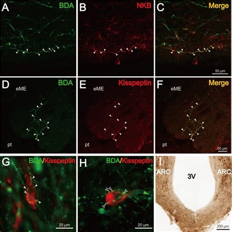 Co Localization Of Bda And Either Nkb Or Kisspeptin In The Me And Arc