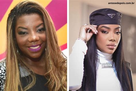 Ludmilla Antes E Depois Da Cantora Ap S Cirurgias Pl Stica Dos Famosos