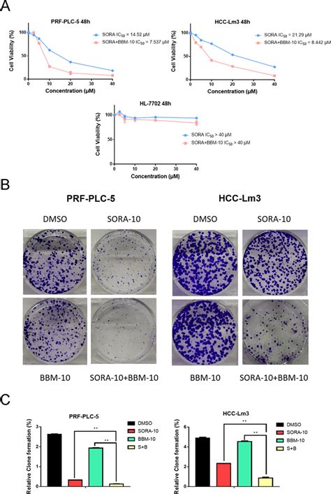 Combined Use Of Bbm And Sora Can Act Synergistically To Inhibit Hcc