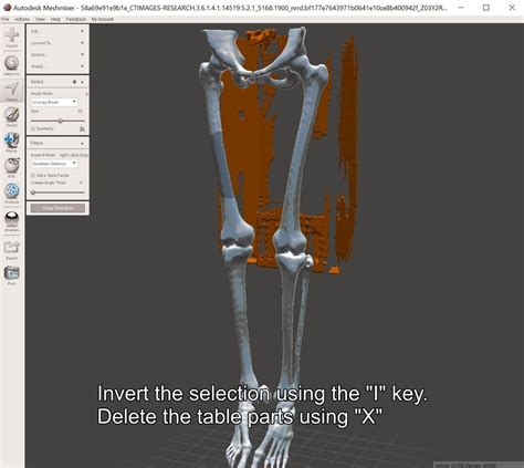 How To Easily And Automatically Convert A Ct Scan Dicom Data Into A 3d Printable Medical Model