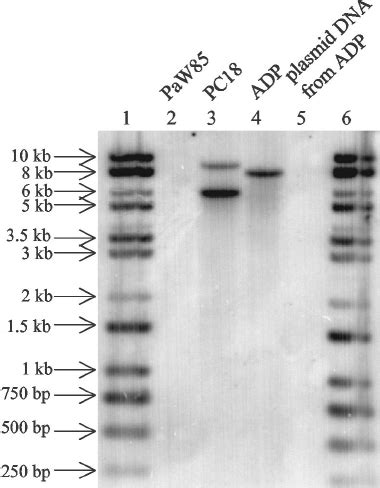 Autoradiograph Of Southern Analysis Of Total Ecori Di Gested Dna Of P