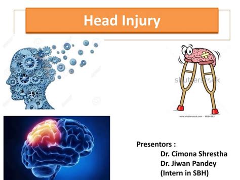 Head injury( Diagnosis/symptoms/investigation/Treatment) | PPT