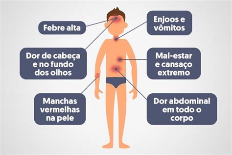 Principais Sintomas Da Dengue Clássica E Hemorrágica Tua Saúde