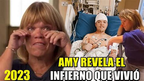 AMY ROLOFF HABLA DEL INFIERNO QUE VIVIO CON LA CIRUGIA CEREBRAL DE ZACH