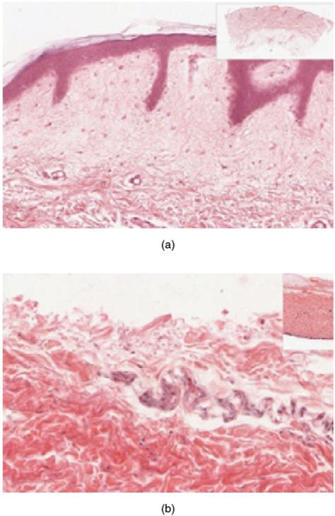 Integumentary System Building A Medical Terminology Foundation