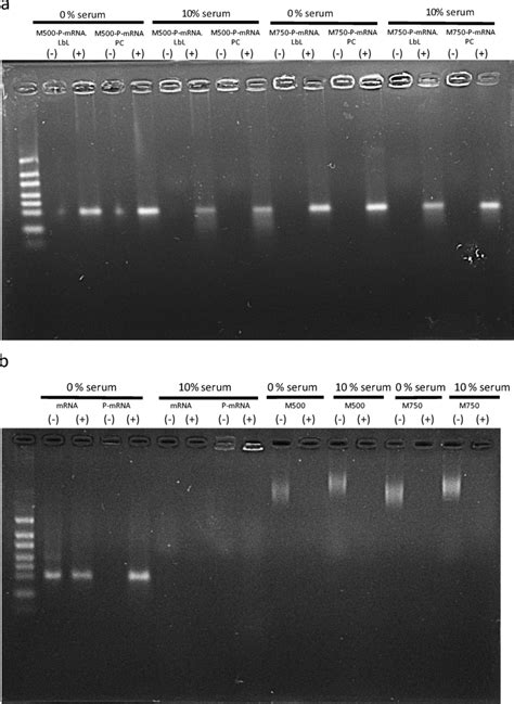 Agarose Gel Electrophoresis Analysis Of Micelle Assemblies M P Gfp