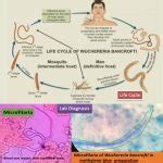 Filariasis Introduction Classification Life Cycle Clinical Features