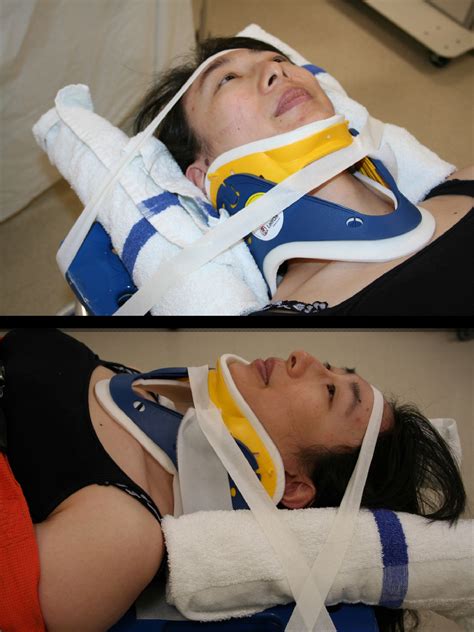 Cervical Spine Injury Approach To The Trauma Patient Operative