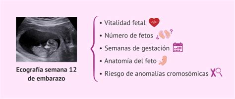 Ecografía De Las 12 Semanas De Embarazo