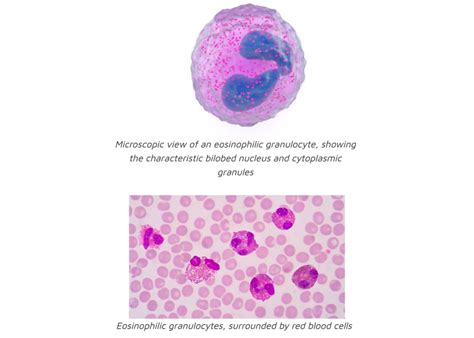 Snegid What Is An Eosinophil