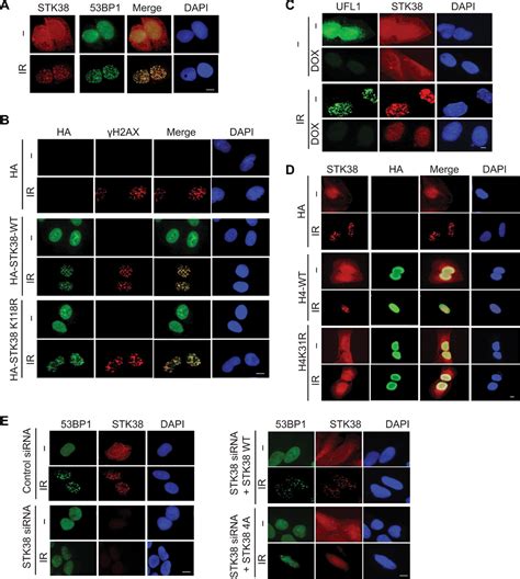 Stk Promotes Atm Activation By Acting As A Reader Of Histone H