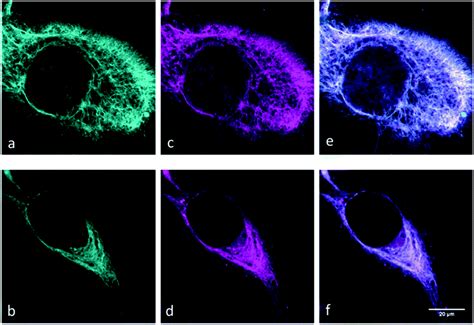 Bioorthogonal Double Fluorogenic Siliconrhodamine Probes For