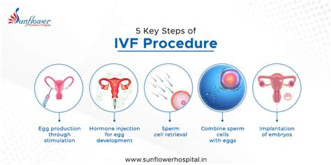 Key Steps Of Ivf Procedure