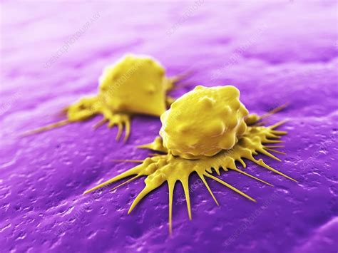 Cancer Cells Dividing Artwork Stock Image F005 0541 Science